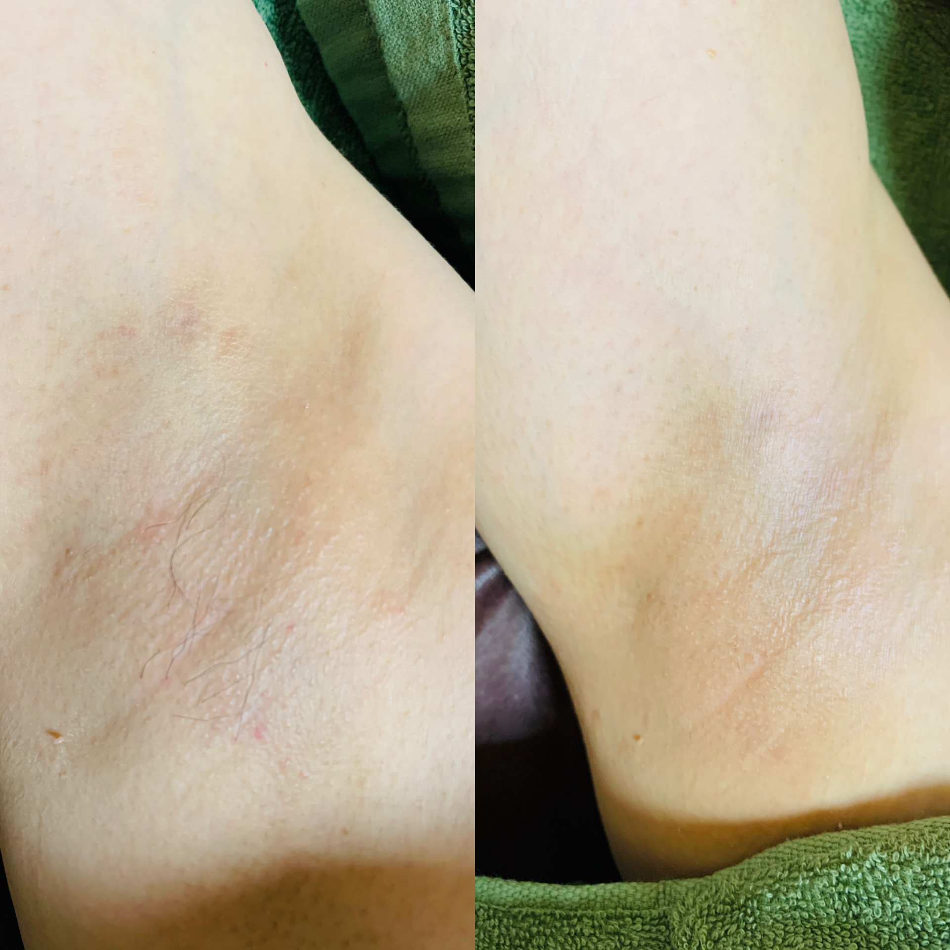 変化写真　脇　【Bohe Me shop】